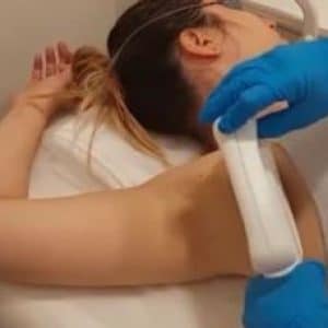 depilacion-laser-indolora-en-trisquel-estetica